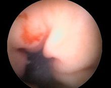 胃神经官能症(图2) 胃神经官能症(图2)