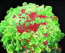 感染HIV的T细胞